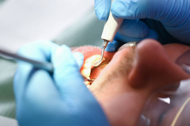 Best Broken Tooth Emergency  in Homestead, PA