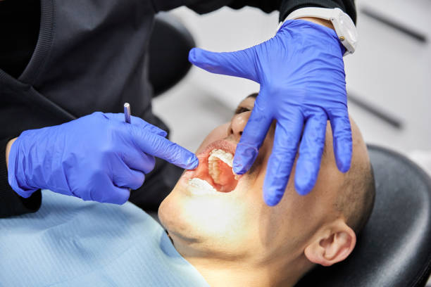 Best Chipped Tooth Repair Near Me  in Homestead, PA